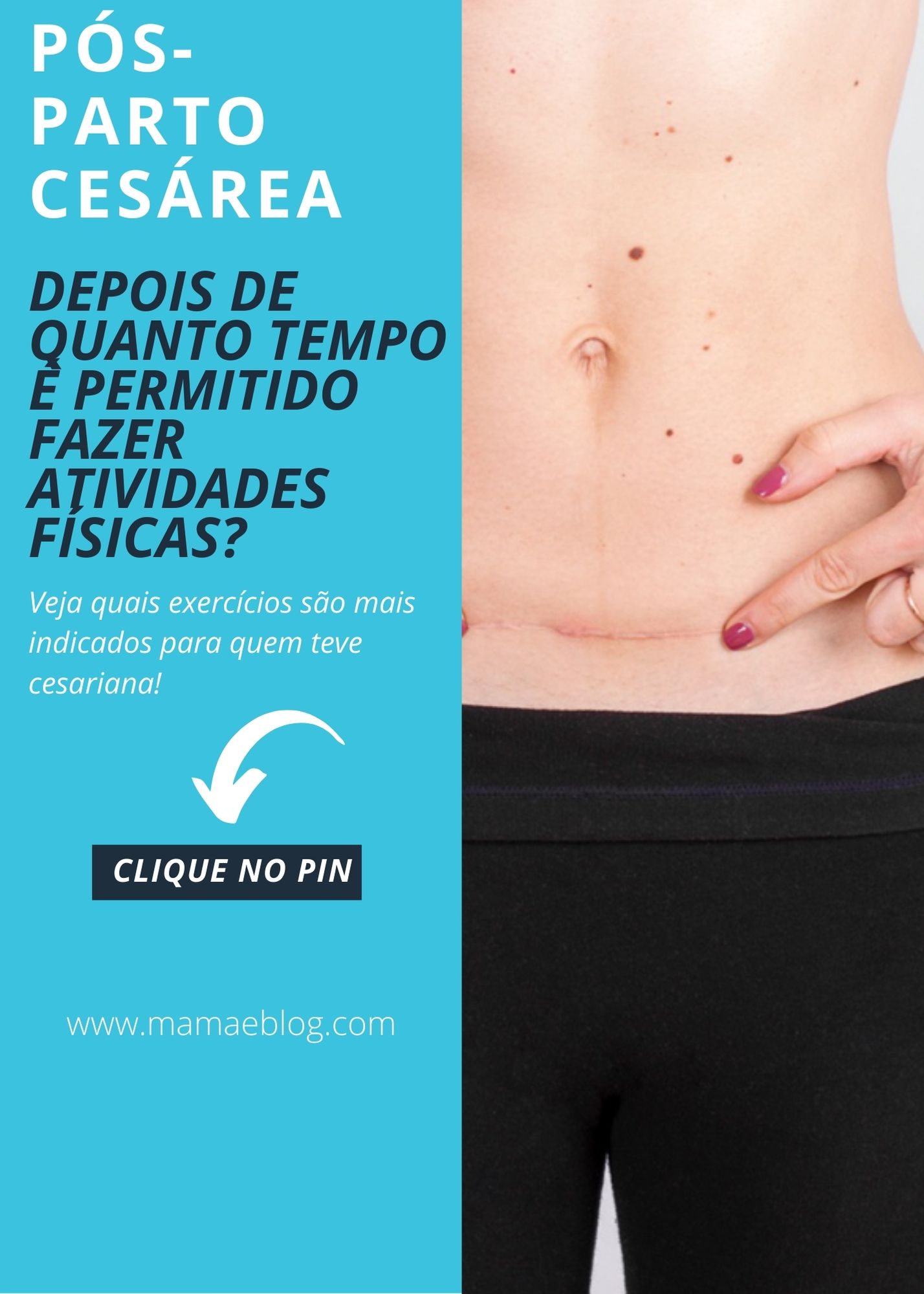 Quanto Tempo Depois De Uma Cesárea Posso Ter Parto Normal - FDPLEARN